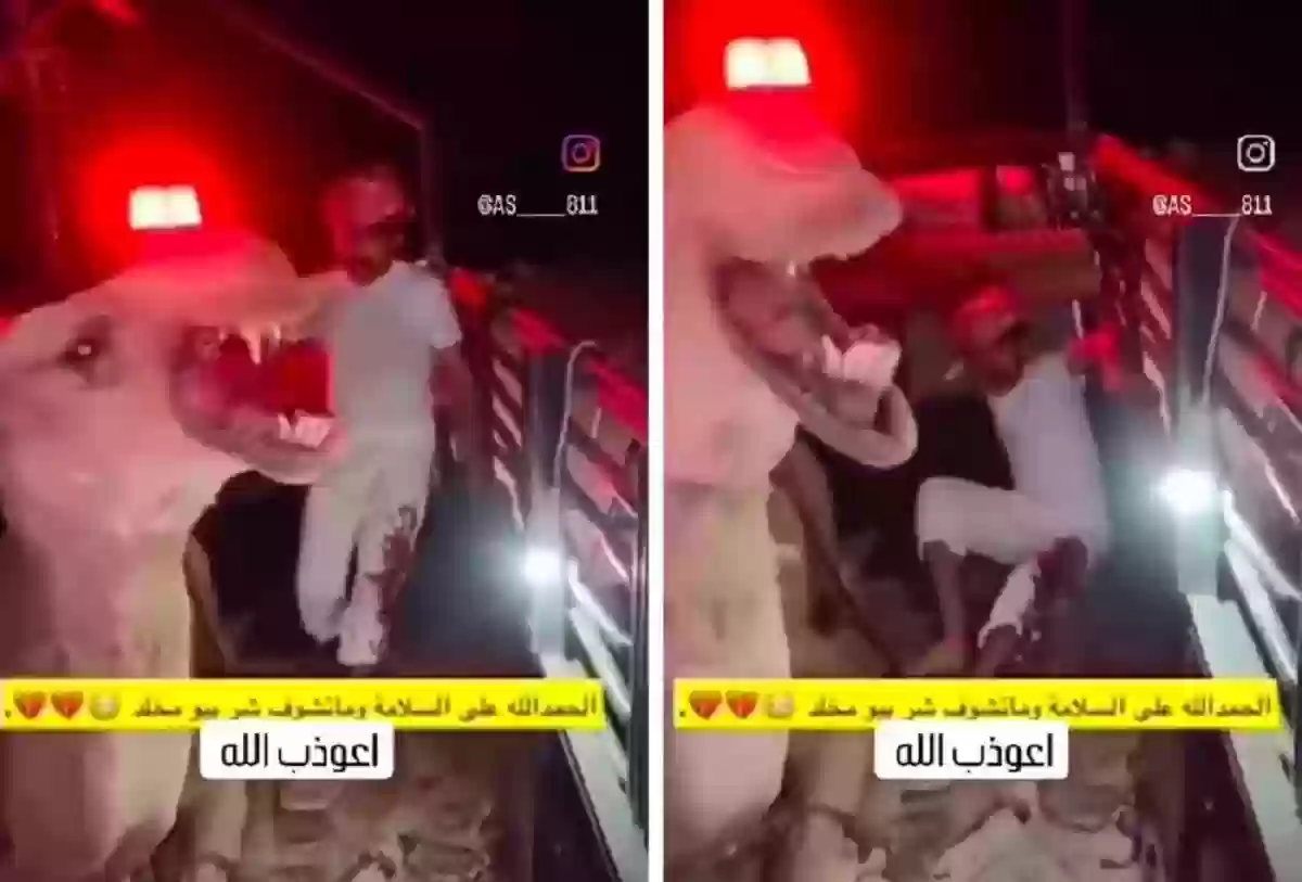 شاب سعودي يثير الجدل بإصابته في قدمه من جمل هاجمه «مثير للشكوك»